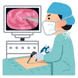 腹腔鏡手術イラスト画像