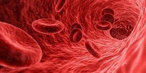 血管内の画像