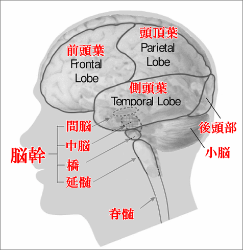 パーキンソン病脳の図解